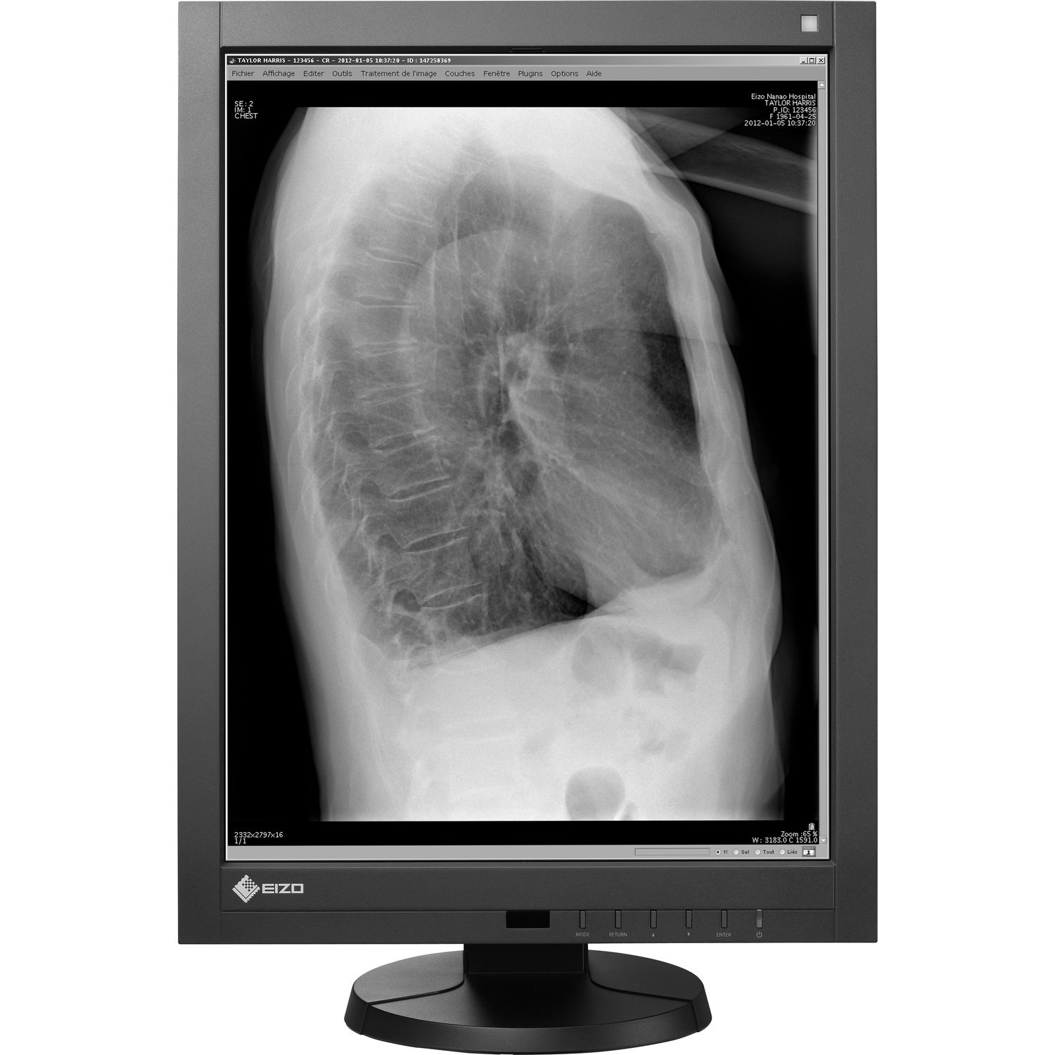 EIZO RadiForce GX240-CL-P 21" Class UXGA LCD Monitor - 4:3 - Black