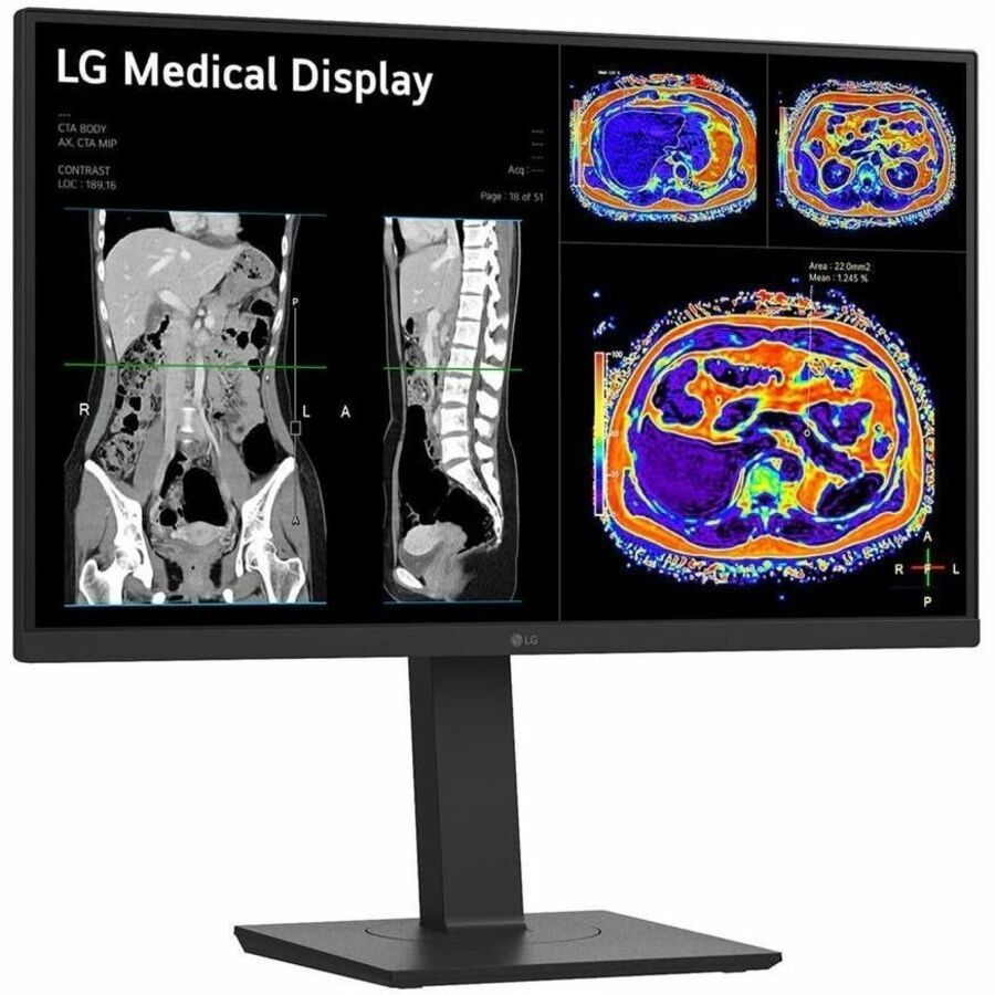 LG 27HS713C-B 27" Class Webcam 4K UHD LED Monitor - 16:9 - Black