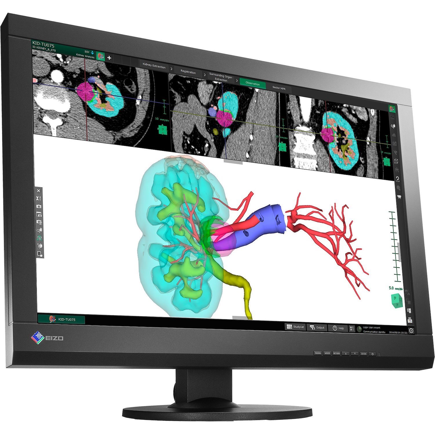 EIZO RadiForce MX242W 24" Class WUXGA LCD Monitor - 16:10 - Black