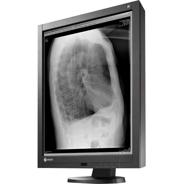 EIZO RadiForce GX240-CL-P 21" Class UXGA LCD Monitor - 4:3 - Black